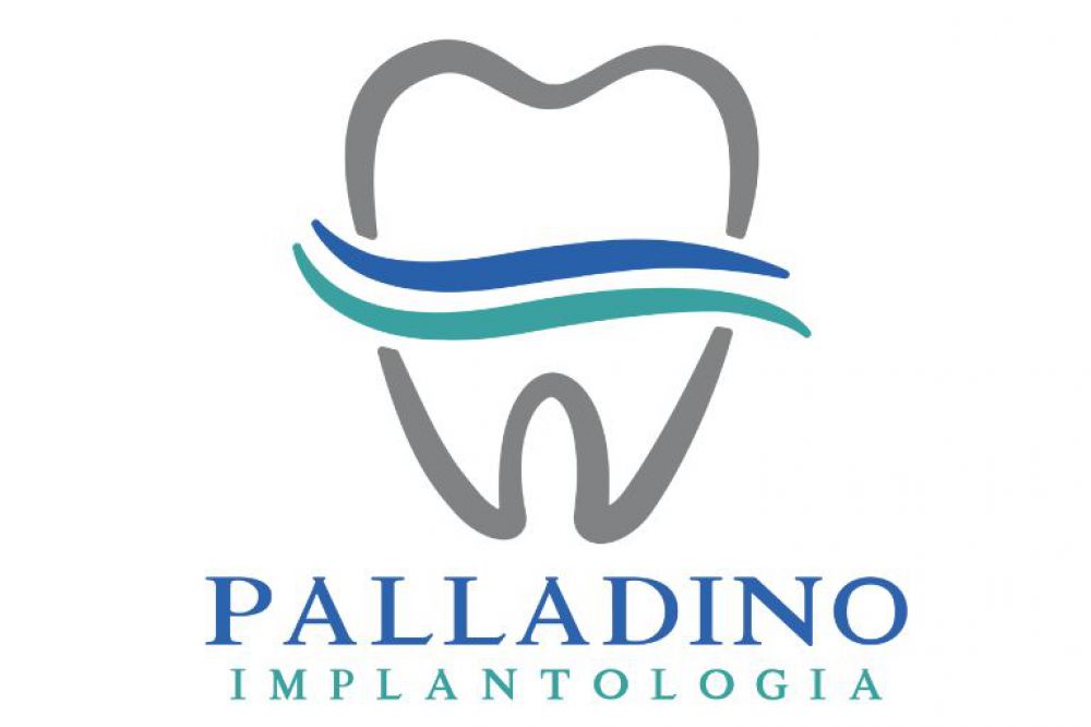 Palladino Implantologia